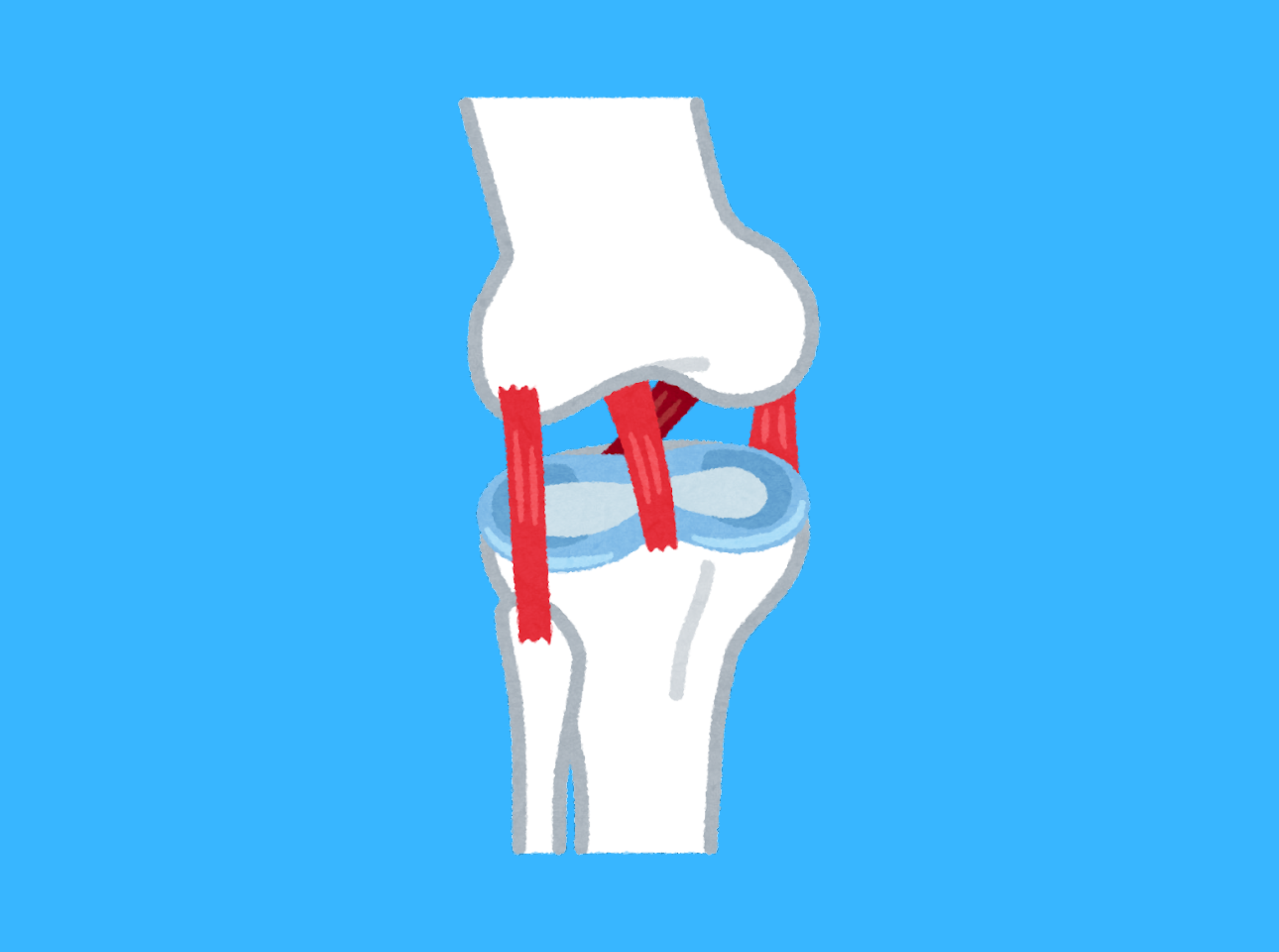 Orthopedic